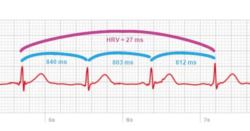 Measure HRV from ECG